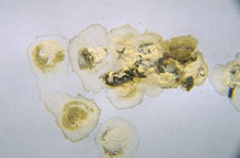abnormal_droppings-1 abnormal_droppings-1